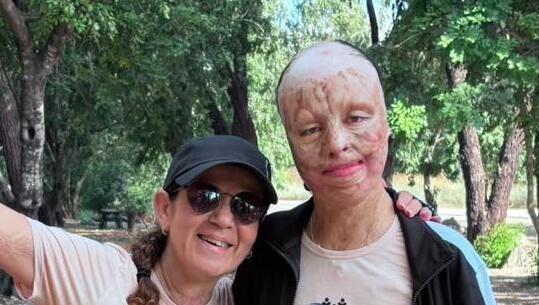 "היו שפחדו מבתי בגלל המראה, היא האמינה בעצמה"