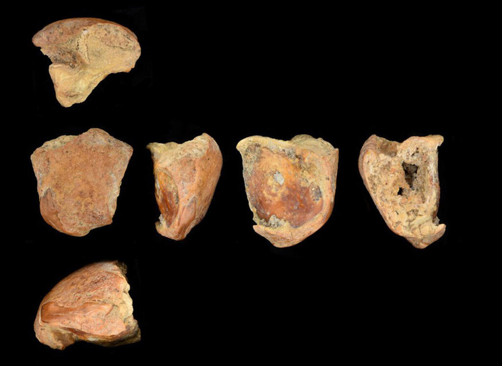 Different views of the split tooth; the Neanderthals took care of their own (Photo: Dr. Emma Pomeroy) זוויות שונות של השן החותכת, אשר נבקעה לאורכה