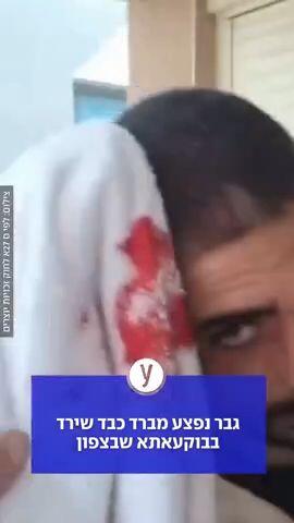 גבר נפצע מברד כבד שירד בבוקעאתא שבצפון