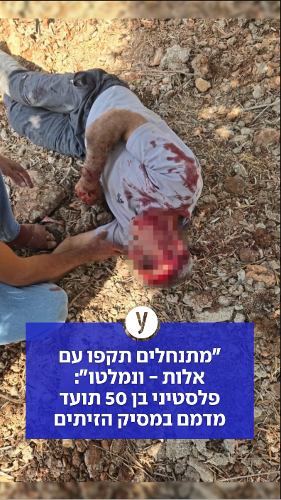 "מתנחלים תקפו עם אלות - ונמלטו": פלסטיני בן 50 תועד מדמם במסיק הזיתים