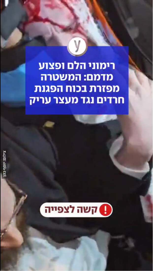 רימוני הלם ופצוע מדמם: המשטרה מפזרת בכוח הפגנת חרדים נגד מעצר עריק