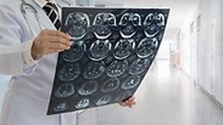 הפעוטה לא נשלחה ל-MRI