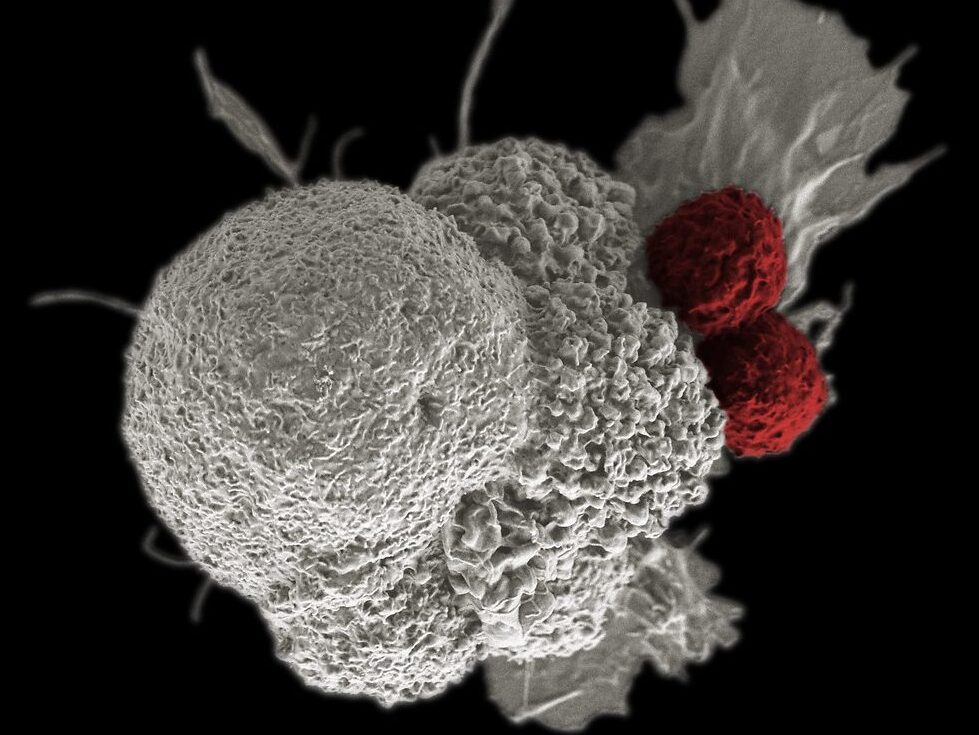 Cancer cells 