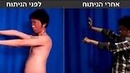 שיפור ניכר בתפקוד הגפה