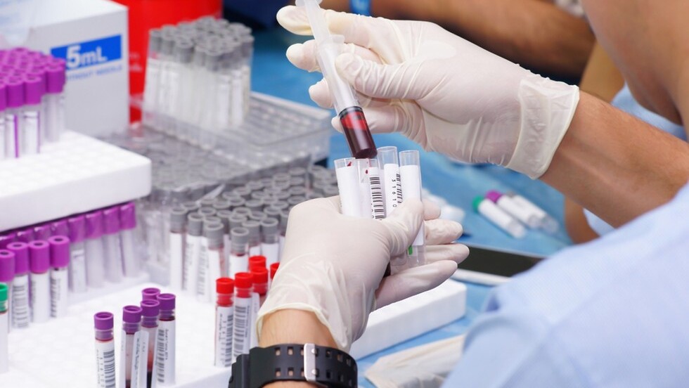 Blood tests being conducted in a lab 
