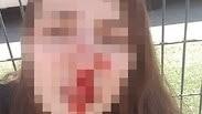 אישה שהותקפה ע"י גבר בעפולה
