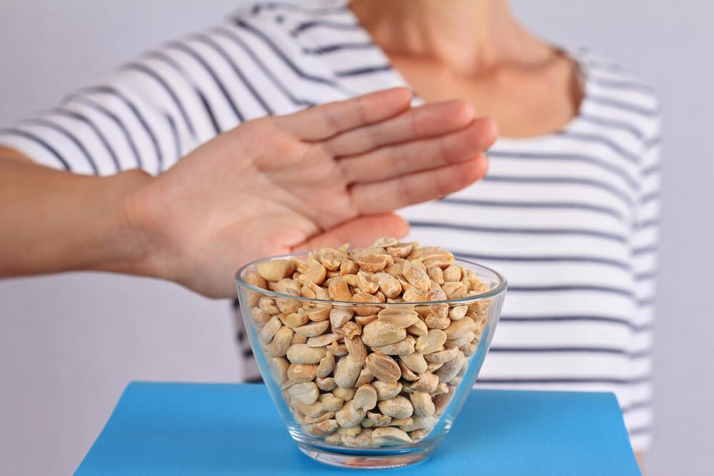 אלרגיה לבוטנים עלולה לסכן חיים (צילום: shutterstock) רגישות לבוטנים
