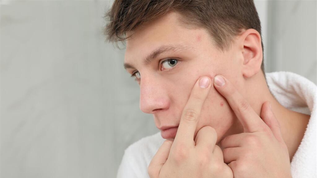 דימוי גוף בגיל ההתבגרות. אילוסטרציה (צילום: shutterstock) אקנה