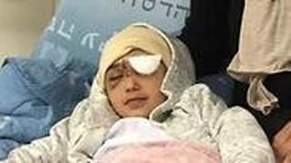 מאלק עיסא בבית החולים הדסה עין כרם