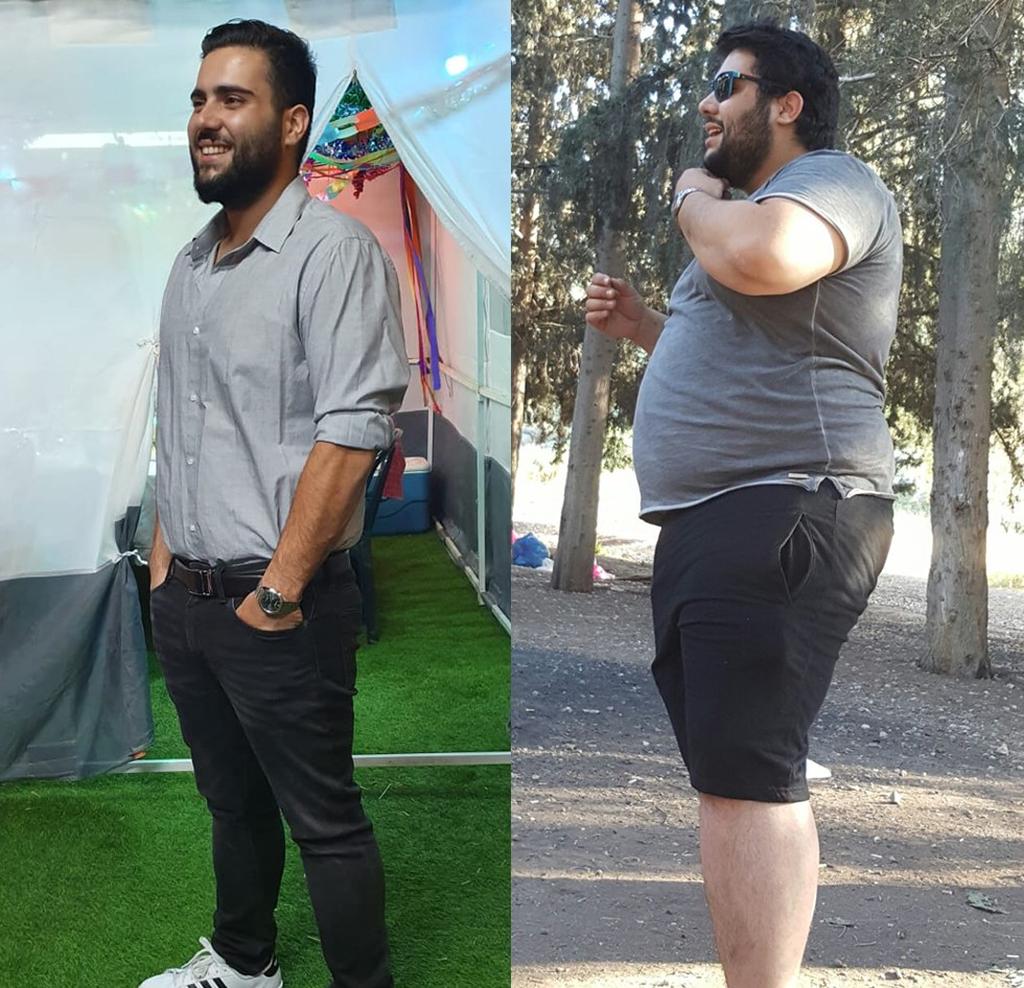 עמית מור לפני ואחרי (צילום פרטי ) עמית מור לפני ואחרי