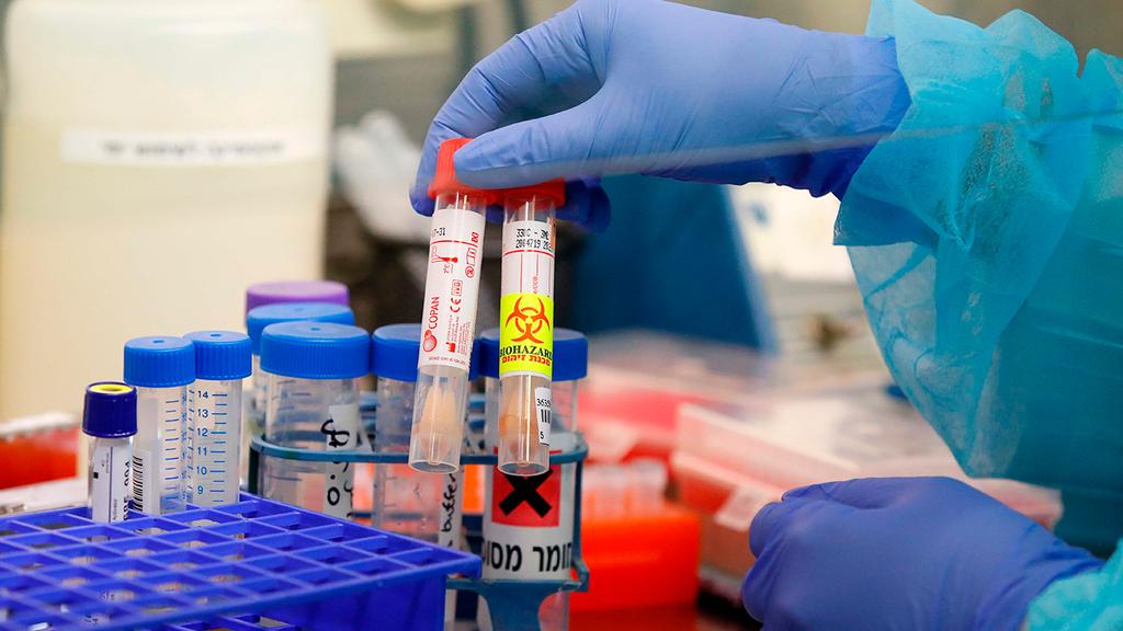 Coronavirus testing kits at Ichilov Hospital in Tel Aviv (Photo: AFP) Coronavirus testing kits at Ichilov Hospital in Tel Aviv
