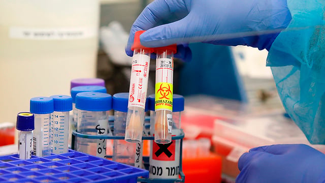 Coronavirus testing kits at Ichilov Hospital (Photo: AFP) Coronavirus testing kits at Ichilov Hospital