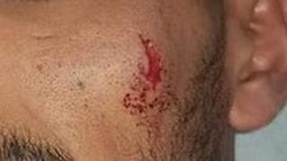 בלאל ג'בר אלאעסם הוכה ע"י שוטרים בגלל טעות בזיהוי