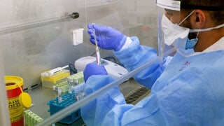  חוקרים מצאו: קרישי דם קטלניים הם גורם הסיכון במחלת קורונה קשה