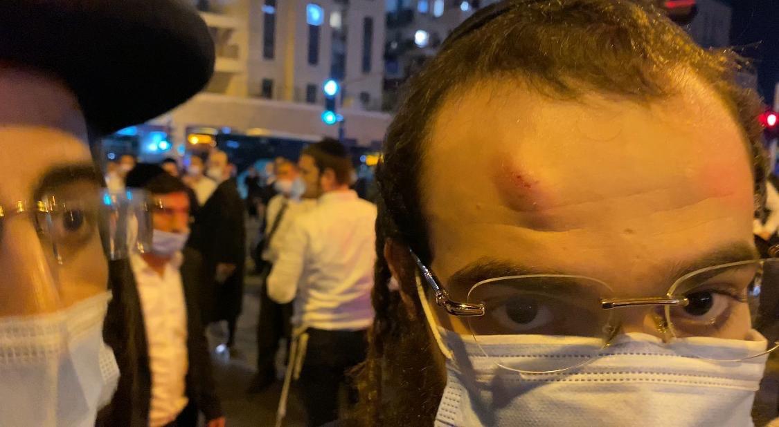 שוטר היכה מפגין שלא עטה מסכה בעימותים בירושלים