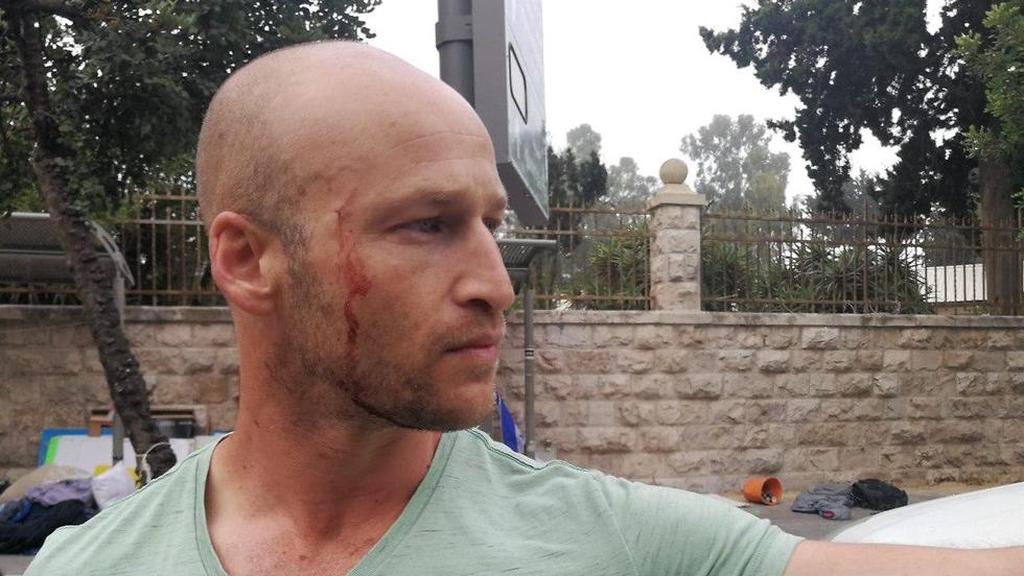 רועי פלג. "הוראה מלמעלה" כוחות משטרה ופקחים הגיעו הבוקר למאהל המחאה בבלפור ופינו משם כ-30 מפגינים וציוד