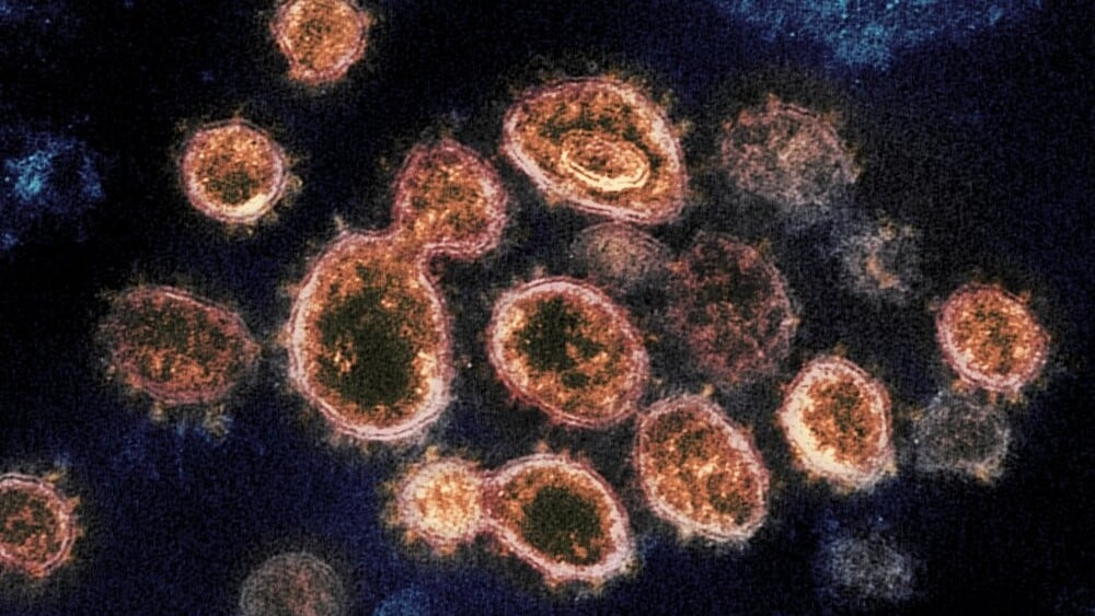 SARS-CoV-2 virus particles which causes COVID-19 (Photo: AP) This 2020 electron microscope image provided by the National Institute of Allergy and Infectious Diseases - Rocky Mountain Laboratories shows SARS-CoV-2 virus particles which causes COVID-19, isolated from a patient in the U.S., emerging from the surface of cells cultured in a lab