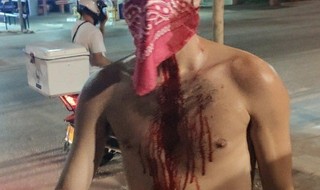 מפגין שהותקף בהפגנה בתל אביב