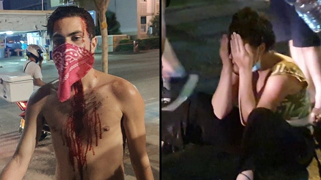 Anti-government protesters after being attacked by alleged Netanyahu supporters in Tel Aviv on Tuesday night תומכי נתניהו היכו מפגינים של הדגלים השחורים