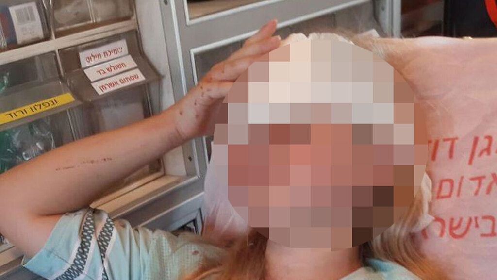 בת ה-10 שנרגמה באבנים ונפצעה ילדה בת 10 נפצעה מטרור אבנים