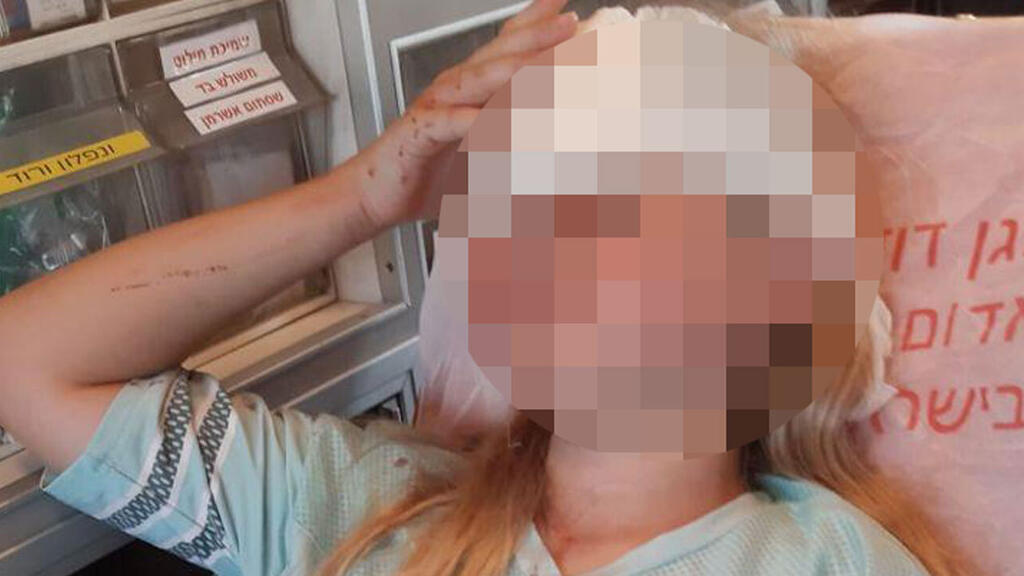בת ה-10 שנפצעה בפיגוע ילדה בת 10 נפצעה מטרור אבנים