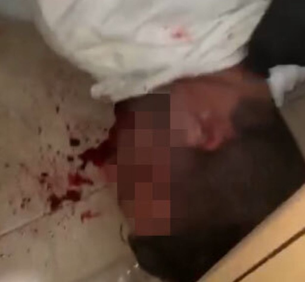אחי הכלה, שנעצר ונפצע (צילום:בר גינזברג) כוחות משטרה הגיעו לבית בישוב גבעת זאב בעקבות אירוע שהתקיים במקום תוך הפרת התקנות