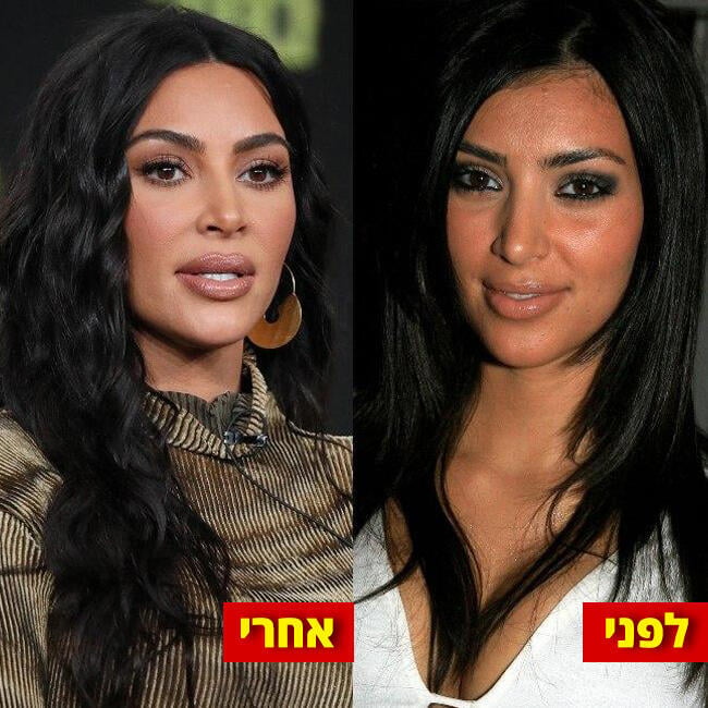 האף, עור הפנים, הכל שם שונה! (צילום: Gettyimages) האף, עור הפנים, הכל שם שונה!