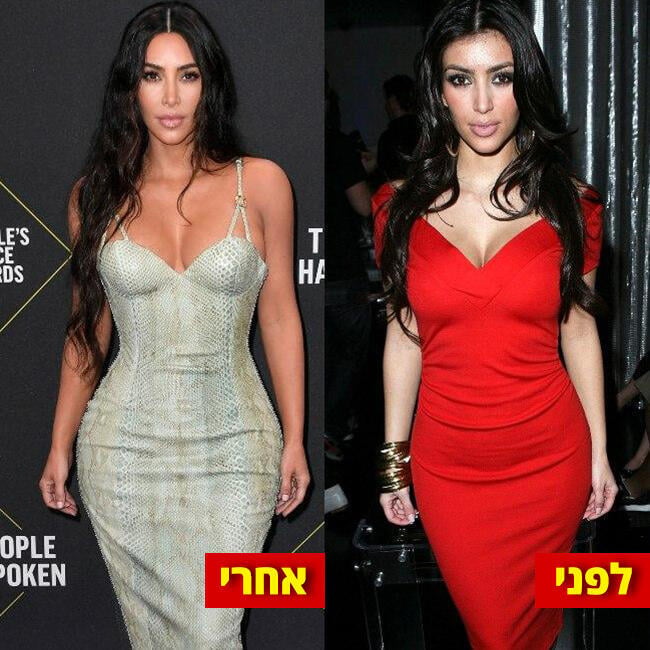 יחי ההבדל. קים קרדשיאן (צילום: Gettyimages) יחי ההבדל. קים קרדשיאן