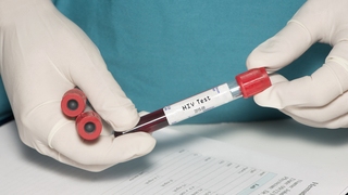 איידס HIV