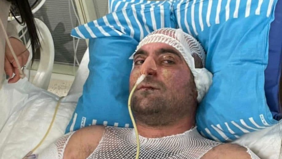 יניב אימנילוב שהוצת על ידי בת זוגתו