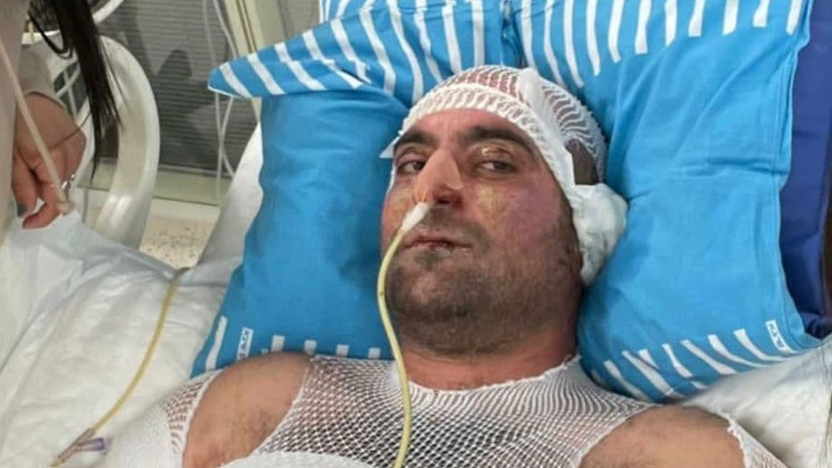 יניב אימנילוב שהוצת על ידי בת זוגתו