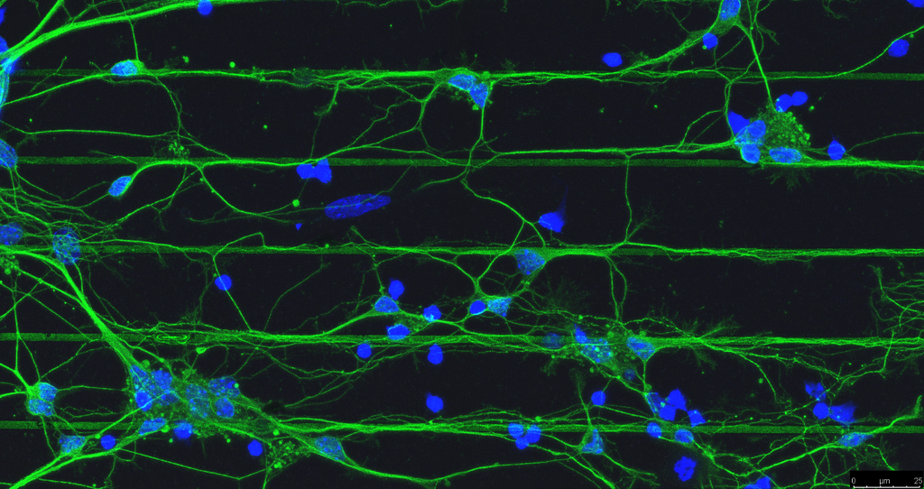 רשת תאי עצב שגדלה על רכיבים עם מבנים טופוגרפיים, שמכוונים את צמיחת התאים ומהווים בסיס לרכיבים לשיקום עצבי אחרי פגיעה. בכחול גרעיני התאים, בירוק (צביעת טובולין) גופי התאים ןהשלוחות