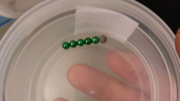 המגנטים שהוצאו מגופה של ליבי מגנטים ליבי
