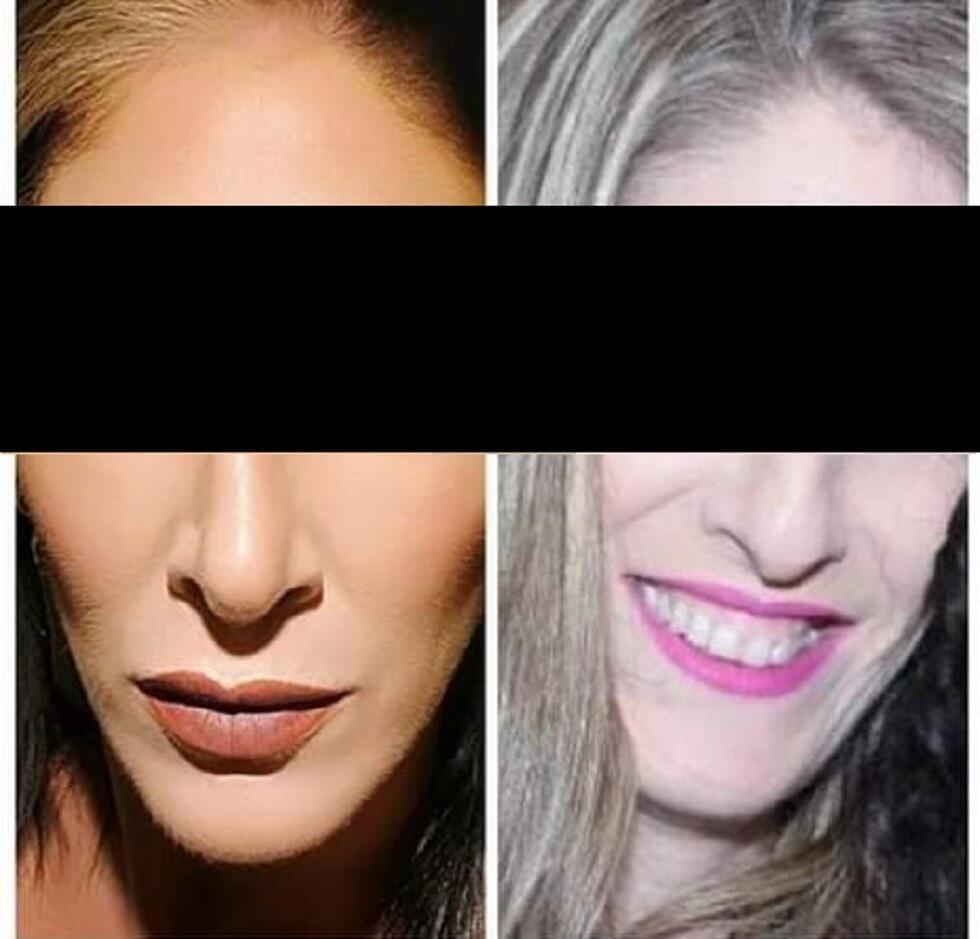 ''הרופא לקח אחריות''. נעמה לפני ואחרי הניתוח הראשון ''הרופא לקח אחריות''. נעמה לפני ואחרי הניתוח הראשון