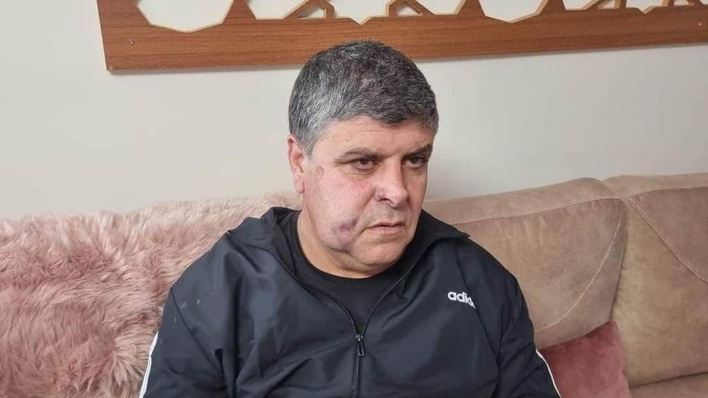 ראש העיר אום אל פחם, סמיר מחאמיד, שנפצע בהפגנה סמיר מחאמיד
