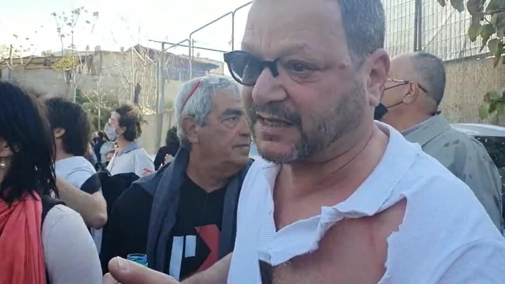 "הפילו אותי לאדמה והמשיכו להכות אותי". ח"כ כסיף אחרי העימות בשייח ג'ראח עופר כסיף