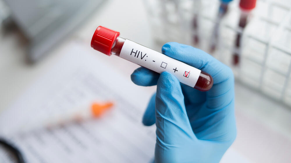 איידס HIV בדיקת דם