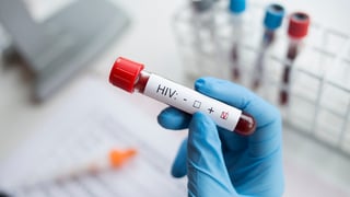 איידס HIV בדיקת דם