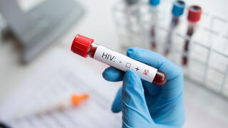 איידס HIV בדיקת דם