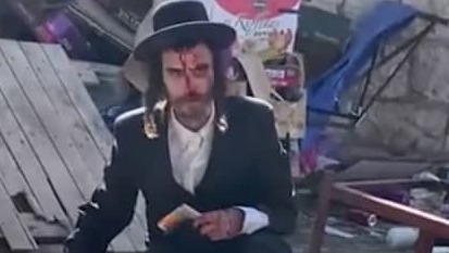 יהודי הותקף על ידי ערבים באזור שער שכם ונפצע בראשו 