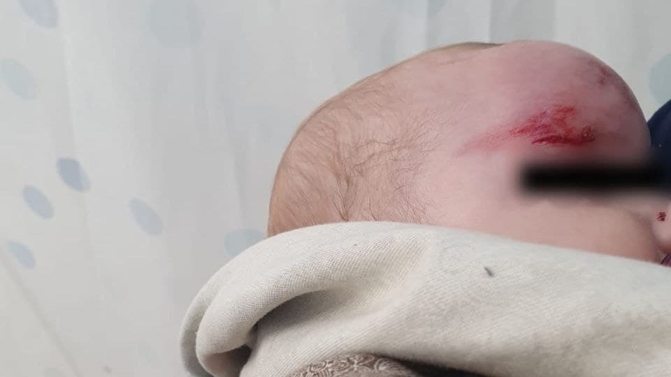 התינוקת שנפצעה מהשלכת אבנים (צילום: דוברות ירושלים) תיעוד השלכת אבנים ופציעת תינוקת