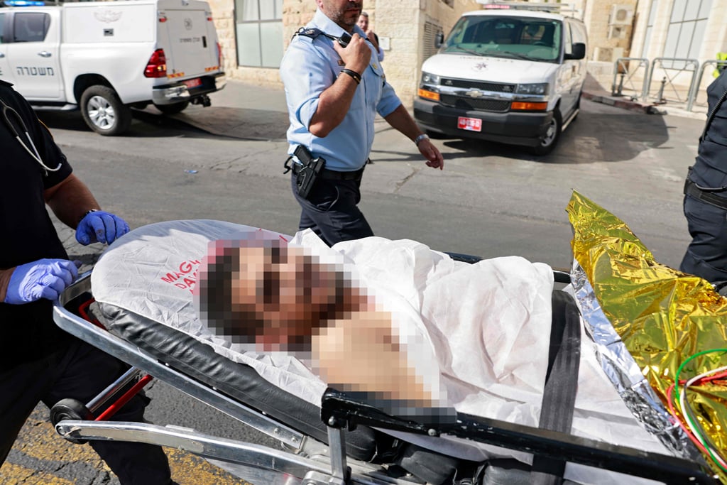 המחבל מפונה מזירת הפיגוע. נורה על ידי כוח מג"ב (צילום: AFP) המחבל מפונה מזירת הפיגוע