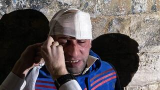ראיד אבו עסב לאחר התקיפה