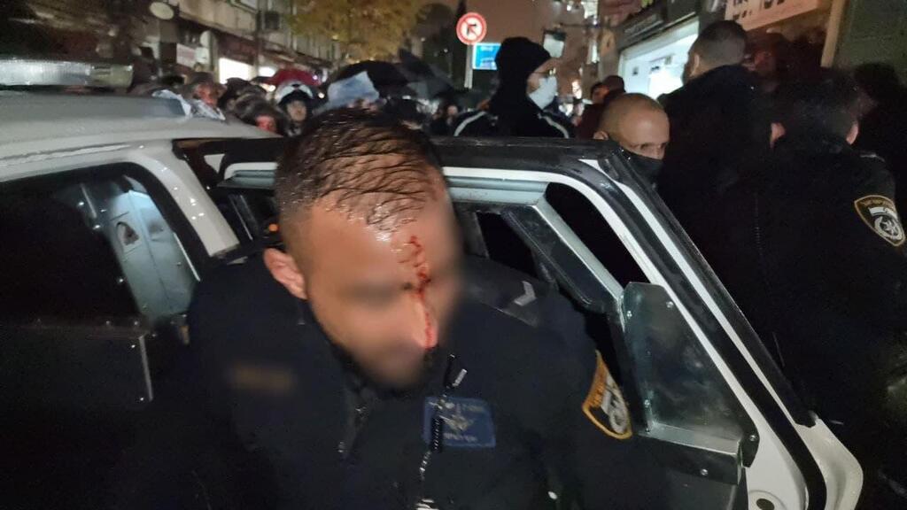 השוטר שנפצע בהפגנה (צילום: דוברות המשטרה) שוטר נפצע קל בהפגנה