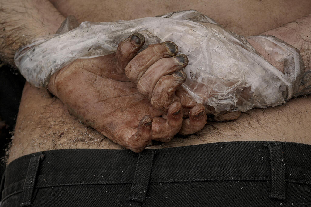 A body found with the hands bound execution style in Bucha (Photo: AP) A body found with the hands bound execution style in Bucha