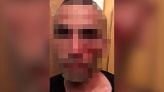תיעוד לאחר התקיפה