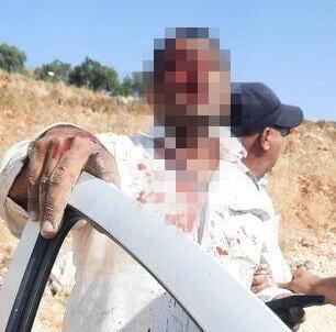 תיעוד מהעימות האלים בין מתנחלים לפלסטינים בין הכפרים מוע'ייר ותורמוסעיא