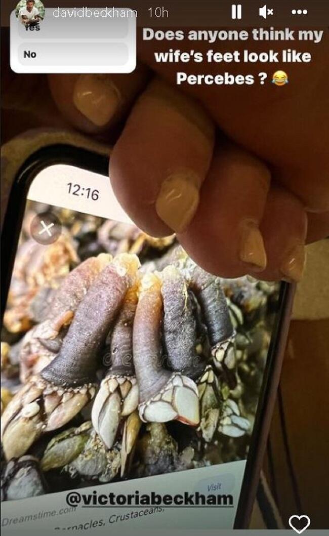 איכס! (צילום: אינסטגגרם) איכס!