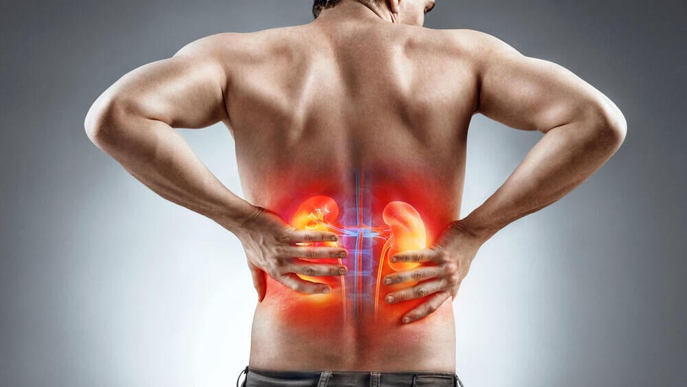 Kidney disease/ Illustration (Photo: Shutterstock) כאב כאבים כליות כליה אבנים בכליות גב