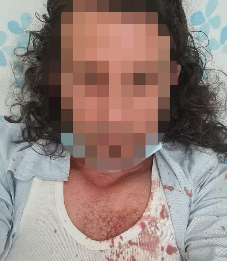 "שבר לי את האף, ונראה שיש לי שבר גם בצלעות", הנהג שהותקף הנהג שהותקף